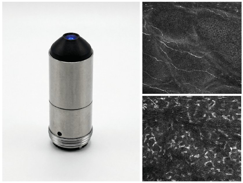 Corneal Observation Lens High-Performance Lenses