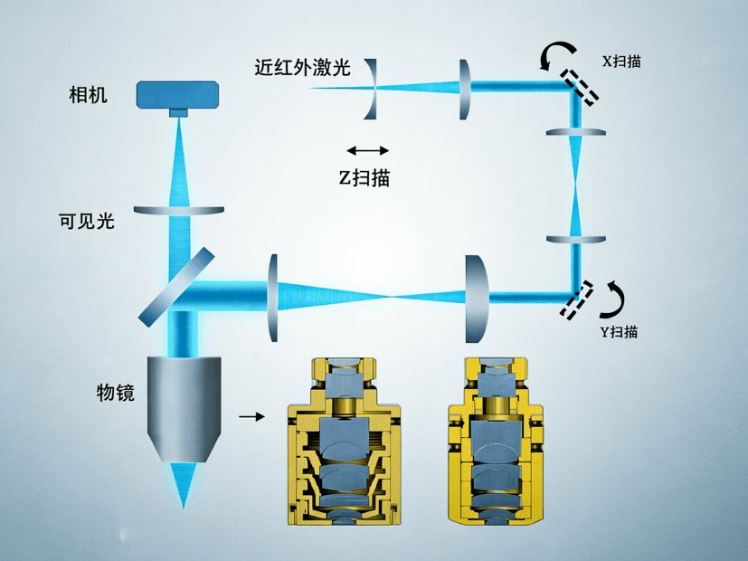 Corneal Reshaping Laser Scanning System Laser Scanning and Ranging